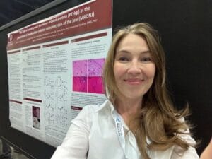 Woman taking a selfie in front of a scientific research poster about parathyroid hormone-related protein and osteonecrosis of the jaw at a conference.